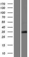 CCDC69 Human Over-expression Lysate