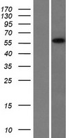 CCDC9 Human Over-expression Lysate