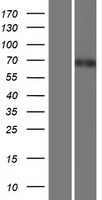 TOR1AIP1 Human Over-expression Lysate