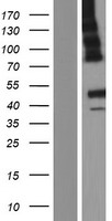 ABHD12 Human Over-expression Lysate