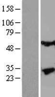 Kallikrein 13 (KLK13) Human Over-expression Lysate