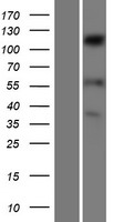 SENP6 Human Over-expression Lysate