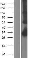 CTRP5 (C1QTNF5) Human Over-expression Lysate