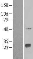 NAT9 Human Over-expression Lysate