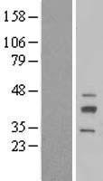 RIBC2 Human Over-expression Lysate