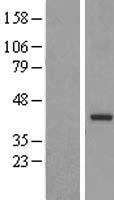 TRUB2 Human Over-expression Lysate
