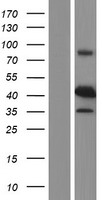 p53R2 (RRM2B) Human Over-expression Lysate