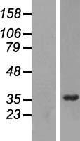RRP7A Human Over-expression Lysate