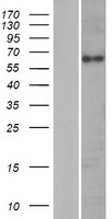 Cytokeratin 2 (KRT76) Human Over-expression Lysate
