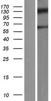 MBD1 Human Over-expression Lysate