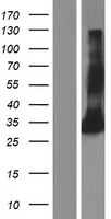 Ficolin 2 (FCN2) Human Over-expression Lysate