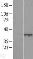WARS2 Human Over-expression Lysate