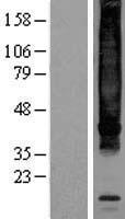 Neurokinin 1 Receptor (TACR1) Human Over-expression Lysate