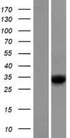 RDH8 Human Over-expression Lysate