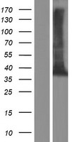 TEX264 Human Over-expression Lysate