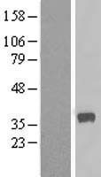 CALHM2 Human Over-expression Lysate