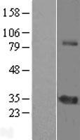 ZNF691 Human Over-expression Lysate