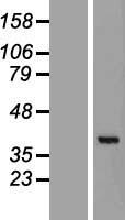 CEE (GET4) Human Over-expression Lysate