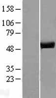 ATP6V1H Human Over-expression Lysate