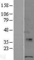 POLR1D Human Over-expression Lysate
