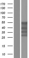 YBX2 Human Over-expression Lysate