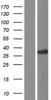 CRYL1 Human Over-expression Lysate