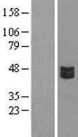 CRLF3 Human Over-expression Lysate