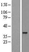 SLC25A39 Human Over-expression Lysate