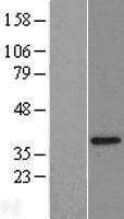CGI 62 (ZC2HC1A) Human Over-expression Lysate