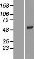 SCCPDH Human Over-expression Lysate