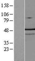 TRNT1 Human Over-expression Lysate