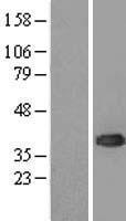 UBC6e (UBE2J1) Human Over-expression Lysate