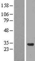 CCDC53 (WASHC3) Human Over-expression Lysate