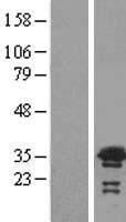 VPS24 (CHMP3) Human Over-expression Lysate