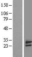 FAM18B (TVP23B) Human Over-expression Lysate