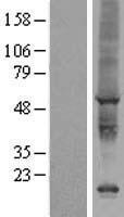AIG1 Human Over-expression Lysate