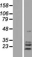 TPPP3 Human Over-expression Lysate
