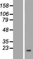 COQ7 Human Over-expression Lysate