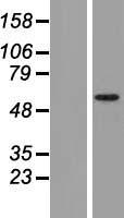 TRIM17 Human Over-expression Lysate