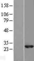 RAB10 Human Over-expression Lysate