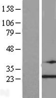 TRAPPC4 Human Over-expression Lysate