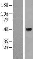 A4GNT Human Over-expression Lysate
