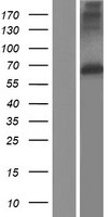 MMP17 Human Over-expression Lysate