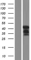 KPC2 (UBAC1) Human Over-expression Lysate