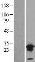 VPS28 Human Over-expression Lysate