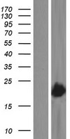 VPS29 Human Over-expression Lysate