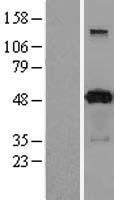 PACSIN3 Human Over-expression Lysate