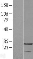 AK3 Human Over-expression Lysate