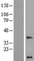 WBP5 (TCEAL9) Human Over-expression Lysate