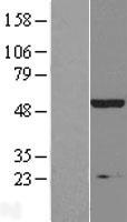Inositol Hexakisphosphate Kinase 2 (IP6K2) Human Over-expression Lysate